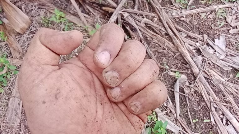 dirty hands for growing a garden, life and career